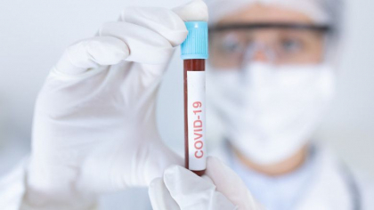 A doua tara din lume, dupa Statele Unite, care depaseste 100.000 de cazuri de coronavirus intr-o singura zi