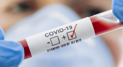 Ultima ora. 700 cazuri de COVID-19 si 27 de decese, inregistrate in ultimele 24 ore