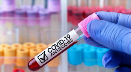 Cate cazuri de coronavirus si decese s-au inregistrat astazi in Moldova