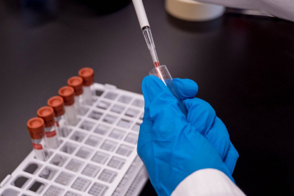 Cate cazuri de coronavirus si decese s-au inregistrat astazi in Moldova