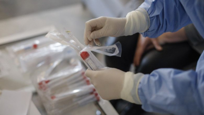 Cate cazuri de coronavirus si decese s-au inregistrat astazi in Moldova