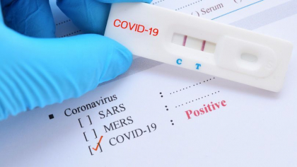 Cati moldoveni au fost prinsi la vama cu teste false la coronavirus, de la inceputul anului. Ce risca acestia Cati moldoveni au fost prinsi la vama cu teste false la coronavirus, de la inceputul anului. Ce risca acestia