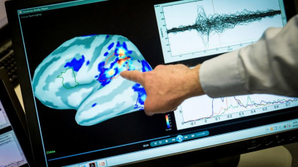 Primul medicament pentru Alzheimer, autorizat in SUA in ultimii 20 de ani. Ce spun medicii despre eficacitatea tratamentului
