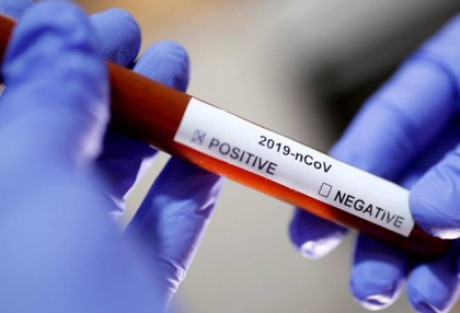 Cate cazuri de coronavirus si decese s-au inregistrat astazi in Moldova