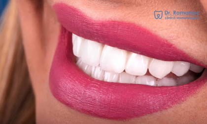 Estetica dentara - un domeniu al stomatologiei care se ocupa de aspectul dintilor si de imbunatatirea aspectului vizual al zambetului