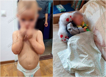 Un copilas de doi ani - gasit pe drumurile din Bender: avea pe el doar scutecul, era murdar si flamand Un copilas de doi ani - gasit pe drumurile din Bender: avea pe el doar scutecul, era murdar si flamand