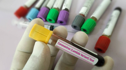 Romania a actualizat lista tarilor cu risc epidemiologic. In care zona se regaseste Republica Moldova Romania a actualizat lista tarilor cu risc epidemiologic. In care zona se regaseste Republica Moldova