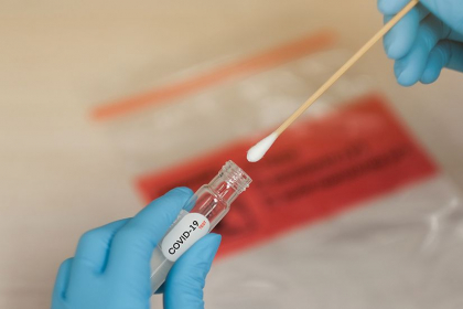 Decis. Testele la Covid-19 vor fi mai ieftine. Un test antigen va costa 35 de lei / DOC