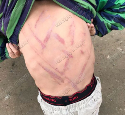 Doi copii au fost batuti pana la sange cu un caplu electric de catre propriul tata, in Transnistria - FOTO Doi copii au fost batuti pana la sange cu un caplu electric de catre propriul tata, in Transnistria - FOTO