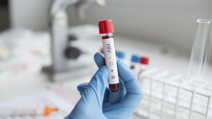 A fost descoperit al doilea pacient care s-a vindecat de HIV fara tratament
