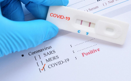 732 cazuri noi de infectare cu COVID-19 au fost confirmate astazi in Republica Moldova 732 cazuri noi de infectare cu COVID-19 au fost confirmate astazi in Republica Moldova