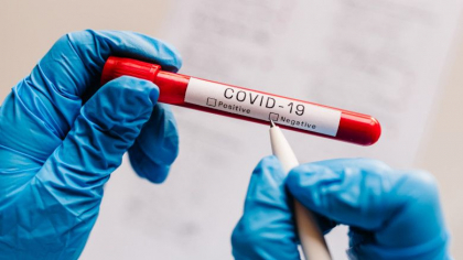 12 cetateni ucraineni, veniti pe teritoriul Republicii Moldova - infectati cu coronavirus. Cate persoane au fost confirmate pozitiv la Covid in ultimele 24 de ore 12 cetateni ucraineni, veniti pe teritoriul Republicii Moldova - infectati cu coronavirus. Cate persoane au fost confirmate pozitiv la Covid in ultimele 24 de ore