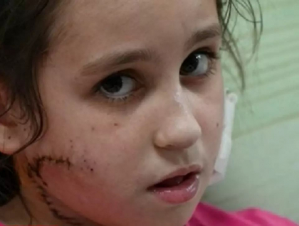 Fetita de 11 ani impuscata in fata de soldatii rusi, care apoi i-au acordat primul ajutor si au trimis-o la spital, langa Mariupol - VIDEO Fetita de 11 ani impuscata in fata de soldatii rusi, care apoi i-au acordat primul ajutor si au trimis-o la spital, langa Mariupol - VIDEO