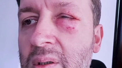 Fostul deputat Artur Resetnicov a scapat de Penitenciarul nr. 13. A fost internat in spital dupa ce a cazut - VIDEO
