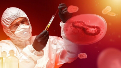 Organizatia Mondiala a Sanatatii cauta un nou nume pentru variola maimutei. Este convocata o intalnire de urgenta Organizatia Mondiala a Sanatatii cauta un nou nume pentru variola maimutei. Este convocata o intalnire de urgenta