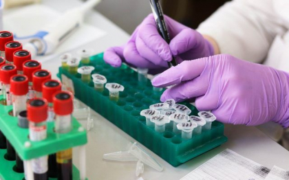 Inca trei cazuri de variola maimutei diagnosticate in Romania. Numarul total ajunge la 14 Inca trei cazuri de variola maimutei diagnosticate in Romania. Numarul total ajunge la 14