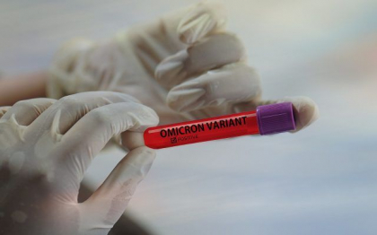Subvarianta Centaurus a Omicron are capacitatea de a ocoli imunitatea data de vaccin si de trecerea prin boala.
Subvarianta Centaurus a Omicron are capacitatea de a ocoli imunitatea data de vaccin si de trecerea prin boala.