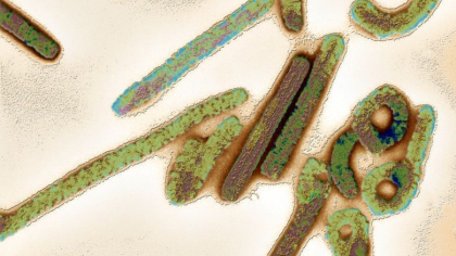 Primele cazuri de infectare cu virusul mortal Marburg, confirmate in Ghana. Cum se transmite si ce simptome prezinta cei infectati