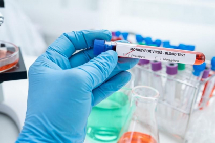 Vaccinul impotriva variolei maimutei nu este un medicament miraculos - avertismentul Organizatiei Mondiale a Sanatatii