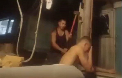 Imagini cu puternic impact emotional. Un rus a preferat sa fie mutilat cu barosul decat sa fie luat in armata - VIDEO Imagini cu puternic impact emotional. Un rus a preferat sa fie mutilat cu barosul decat sa fie luat in armata - VIDEO