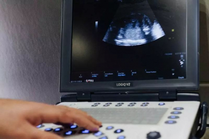 Ultima tara din Europa in care avortul este complet interzis se pregateste sa relaxeze legislatia Ultima tara din Europa in care avortul este complet interzis se pregateste sa relaxeze legislatia