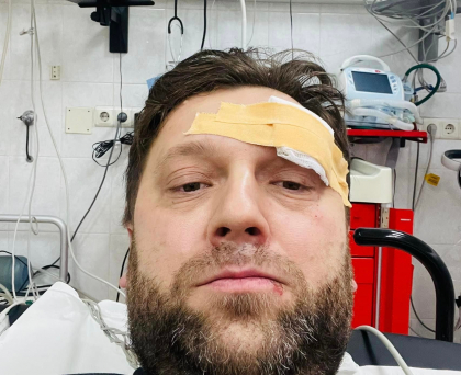 Ministrul Economiei, Dumitru Alaiba - implicat intr-un accident: „Am ajuns in grija medicilor de la spitalul de urgenta” - FOTO