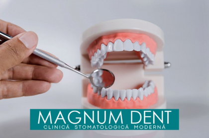 De la Igienizare pana la implantologie. Profita de cele mai bune preturi la serviciile stomatologice din capitala, cu Magnum Dent
