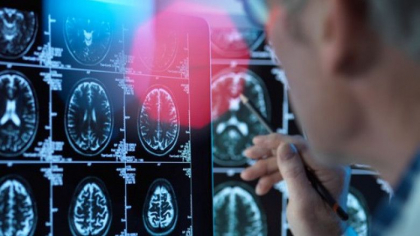 Primul caz de Alzheimer la un pacient de 19 ani. Tanarul a prezentat simptome de la 17 ani si a fost nevoit sa renunte la scoala