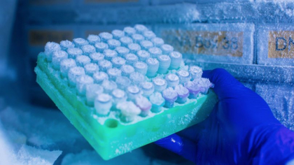 In premiera pentru tara noastra, activitatea bancilor biologice va fi reglementata printr-o lege speciala. Proiect - votat in prima lectura In premiera pentru tara noastra, activitatea bancilor biologice va fi reglementata printr-o lege speciala. Proiect - votat in prima lectura