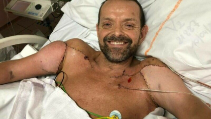 Povestea barbatului care a primit primul transplant de brate din lume. Spune ca vrea sa urce pe Mont Blanc - FOTO Povestea barbatului care a primit primul transplant de brate din lume. Spune ca vrea sa urce pe Mont Blanc - FOTO
