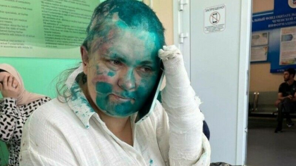Jurnalista celebra, batuta cu bestialitate si rasa in cap de barbati mascati. Atacatorii i-au turnat si vopsea verde in cap