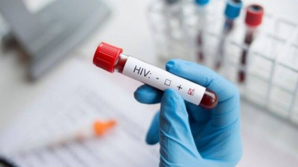 “Pacientul din Geneva”, a sasea persoana vindecata de HIV dupa un transplant de maduva osoasa. De ce este unic acest caz “Pacientul din Geneva”, a sasea persoana vindecata de HIV dupa un transplant de maduva osoasa. De ce este unic acest caz