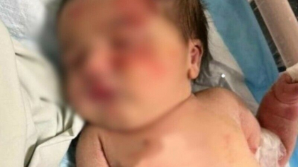 Un bebelus a fost salvat de la moarte de un caine maidanez, dupa ce a fost abandonata intr-un sac de gunoi de parinti