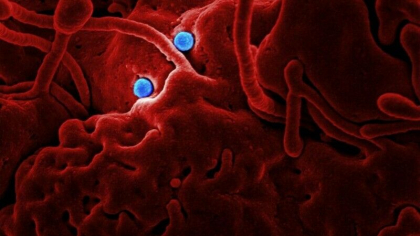Un barbat a fost diagnosticat cu MERS in Emiratele Arabe Unite. Virusul este potential letal si este diferit de Covid-19