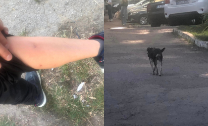 Un copil a fost muscat de un caine maidanez, in sectorul Ciocana al capitalei - FOTO