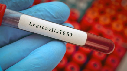 Boala legionarilor ar fi putut veni de la rusi. Polonia investigheaza „implicarea” Rusiei in raspandirea bacteriei Legionella