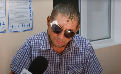 Barbatul din Causeni care a fost mutilat de o haita de caini a ajuns in stare grava la spital: „Cu ochiul drept nu vad deloc, iar gatul imi este rupt” - VIDEO Barbatul din Causeni care a fost mutilat de o haita de caini a ajuns in stare grava la spital: „Cu ochiul drept nu vad deloc, iar gatul imi este rupt” - VIDEO
