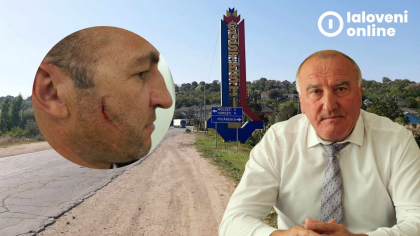 Conflict in plina campanie electorala, la Costesti. Primarul s-a luat la bataie cu un cosilier local: „Eram si eu in sange, si el”- FOTO