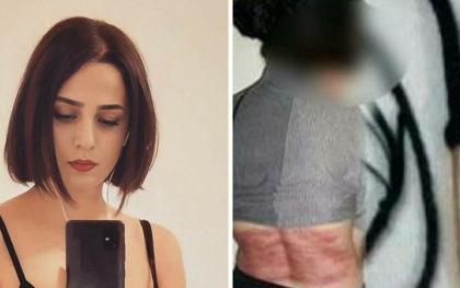 O iranianca a primit 74 de lovituri de bici dupa ce a publicat pe retele de socializare o fotografie in care nu purta valul
O iranianca a primit 74 de lovituri de bici dupa ce a publicat pe retele de socializare o fotografie in care nu purta valul