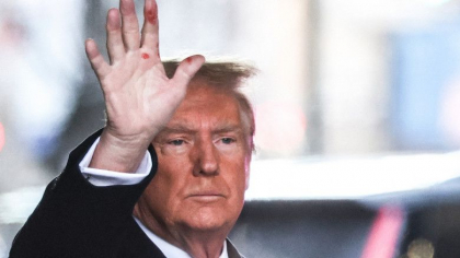 Ranile misterioase de pe mana lui Trump. Un expert in dermatologie a explicat ce ar putea fi Ranile misterioase de pe mana lui Trump. Un expert in dermatologie a explicat ce ar putea fi