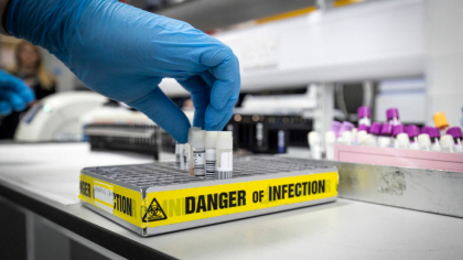 Experții în sănătate sunt în alertă maximă. Un virus mortal care ucide 35% dintre cei infectați ar fi reapărut
Experții în sănătate sunt în alertă maximă. Un virus mortal care ucide 35% dintre cei infectați ar fi reapărut