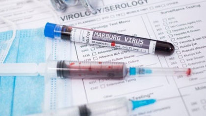 11 oameni au murit din cauza virusului Marburg în Rwanda. Autorităţile apelează la vaccinuri şi tratamente experimentale