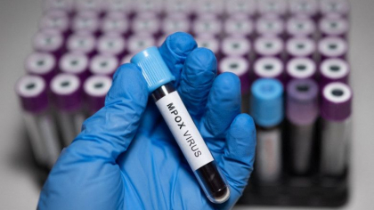 Primul test care poate detecta virusul mpox, cu rezultate imediate, a fost aprobat de OMS