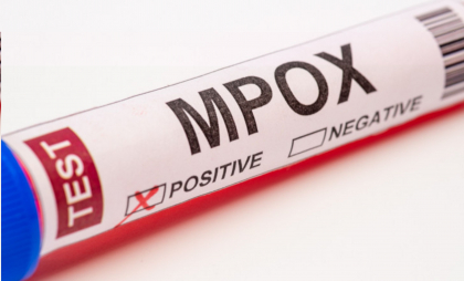 SUA confirmă primul său pacient cu noua formă de mpox SUA confirmă primul său pacient cu noua formă de mpox