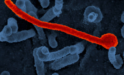 Epidemie de Ebola în estul Africii. Un focar de îmbolnăviri a izbucnit în Uganda


