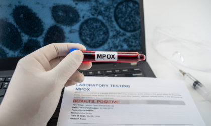 Marea Britanie confirmă un nou caz de infectare cu noua variantă de mpox Marea Britanie confirmă un nou caz de infectare cu noua variantă de mpox