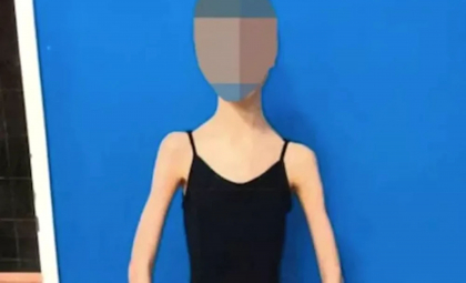 Motivul halucinant pentru care o balerină a fost înfometată de părinți: „La 17 ani cântărea doar 28 de kilograme” - FOTO Motivul halucinant pentru care o balerină a fost înfometată de părinți: „La 17 ani cântărea doar 28 de kilograme” - FOTO