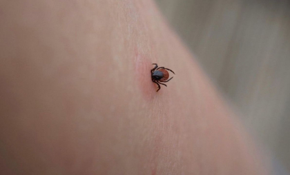 Primul caz de babesioză, depistat pe teritoriul țării: O femeie care a călătorit într-o țară africană a fost diagnosticată cu boala transmisă prin intermediul căpușelor Primul caz de babesioză, depistat pe teritoriul țării: O femeie care a călătorit într-o țară africană a fost diagnosticată cu boala transmisă prin intermediul căpușelor