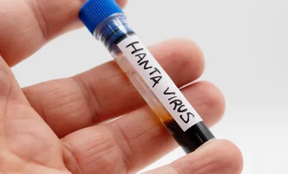 Hantavirus
