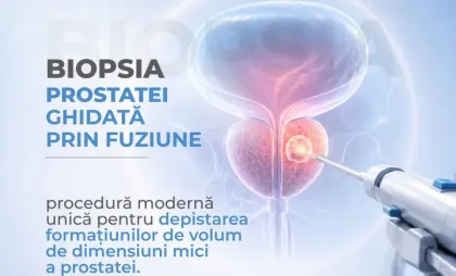 Biopsia de prostată ghidată prin fuziune Biopsia de prostată ghidată prin fuziune
